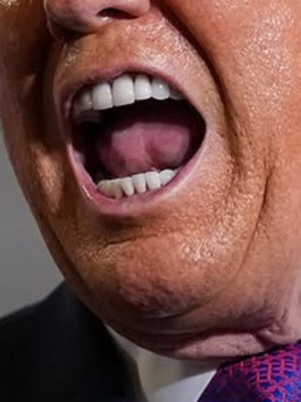 Picture of a Raging Moron Mouth