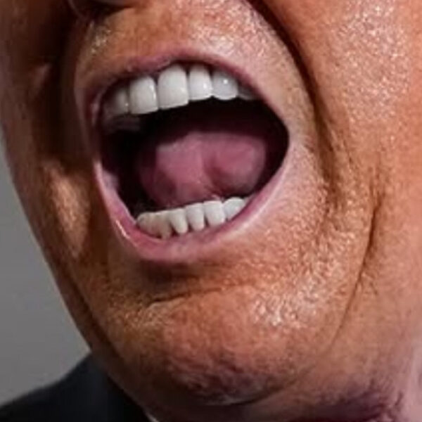 Picture of a Raging Moron Mouth
